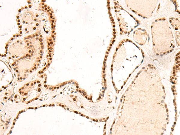 Polyclonal Rabbit anti-Human RMND5B Antibody (IHC)
