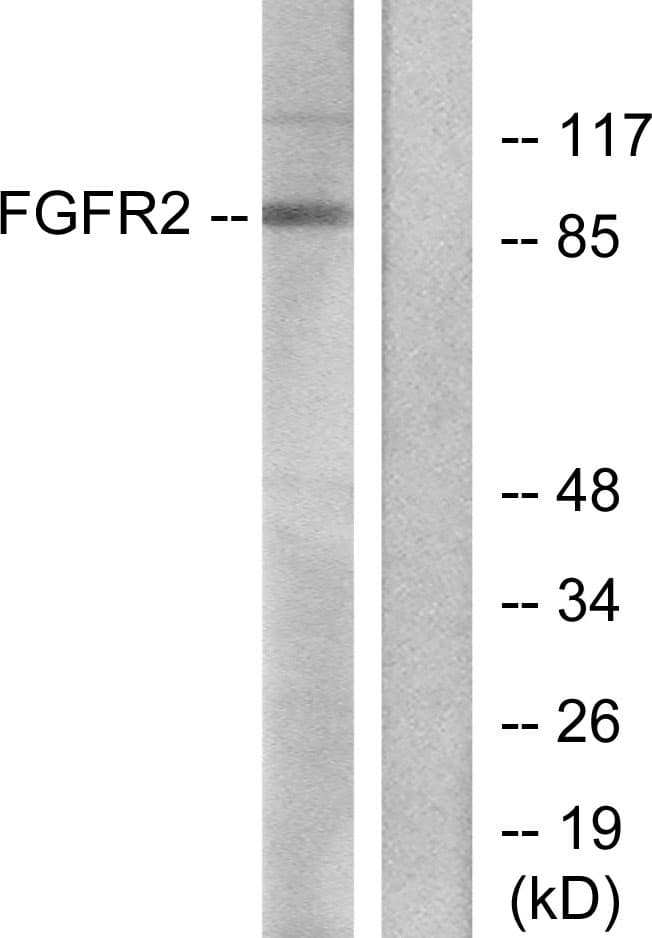 IHC-plus™ Polyclonal Rabbit anti-Human FGFR2 / FGF Receptor 2 Antibody (aa471-520, IHC, WB)