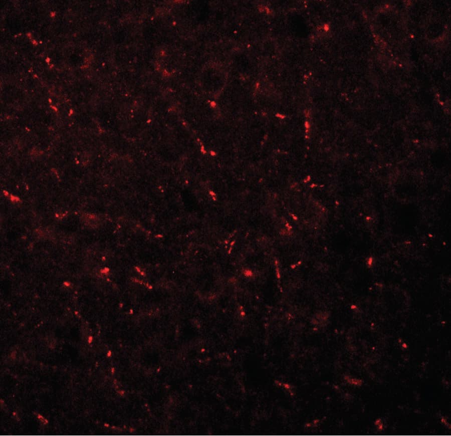AP3M1 Antibody
