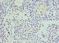HAT1 Antibody (aa245-419)