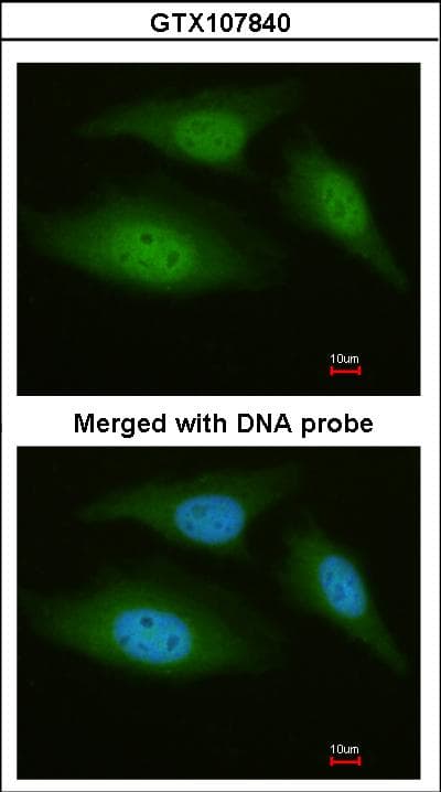 AK8 Antibody (aa192-479)