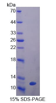 Mouse GPX3 Protein (Recombinant His-T7)