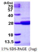 Human C9orf95 / NRK1 Protein (Recombinant His)