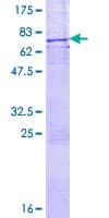 Human TNK2 / ACK1 Protein (Recombinant GST)