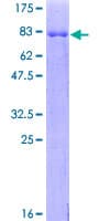 Human CSNK1G2 / CKI-Gamma 2 Protein (Recombinant GST)