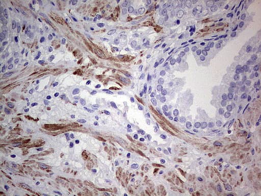 DES / Desmin Antibody (clone UMAB166, Carrier-free)