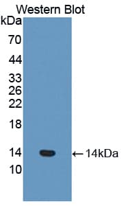 F7 / Factor VII Antibody (aa315-433, PE)