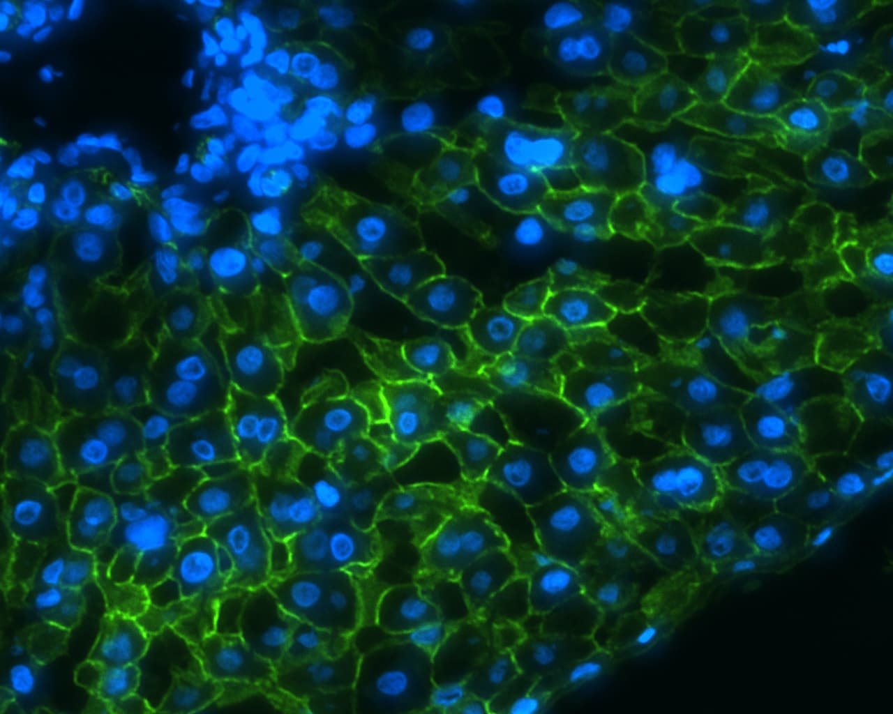 PathPlus™ ADGRG2 / GPR64 Antibody (C-Terminus)