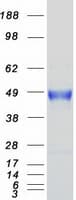 Human CA12 / Carbonic Anhydrase XII Protein (Recombinant Myc-DDK (Flag))