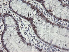 TLE1 / TLE 1 Antibody (aa180-460, clone OTI1F5)