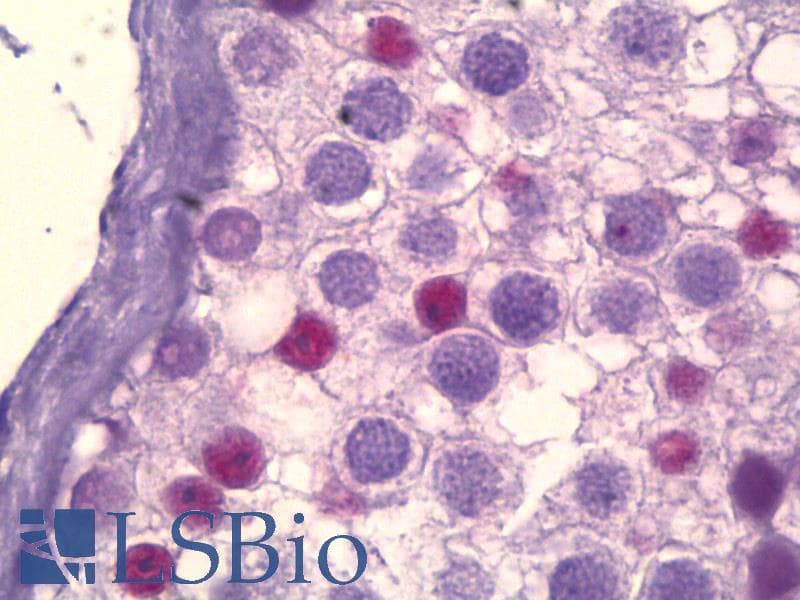 IHC-plus™ Monoclonal Mouse anti-Human CREBBP / CREB Binding Protein Antibody (aa2071-2091, IHC, IF)