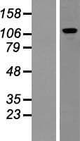 PUM2 Protein (Over-Expression Lysate Myc-DDK (Flag))