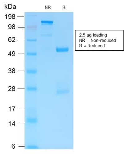 PathPlus™ GFAP Antibody (clone ASTRO/1974R)