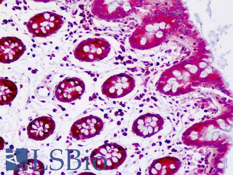 IHC-plus™ SFRP5 Antibody (aa190-219)
