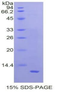 Human MLN / Motilin Protein (Recombinant His)