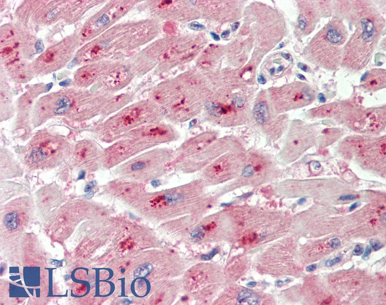 IHC-plus™ PIM2 / Pim-2 Antibody (aa23-36)