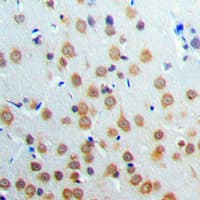 Polyclonal Rabbit anti-Human ANKRD20A3 Antibody (Internal, IHC, WB)