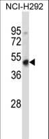 Polyclonal Rabbit anti-Mouse HOXD3 Antibody (aa309-338, WB)