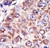 Polyclonal Rabbit anti-Human FDFT1 / Squalene Synthase Antibody (aa1-30, IHC, WB)