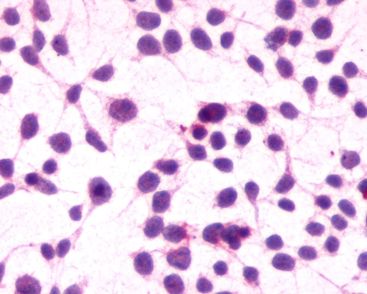 PathPlus™ Polyclonal Rabbit anti-Human CNR1 / CB1 Antibody (C-Terminus, IHC)