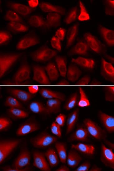 FKBP4 / FKBP52 Antibody