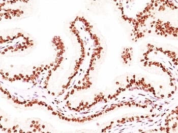 AR / Androgen Receptor Antibody (aa300-316, clone AR441 + DHTR/882)