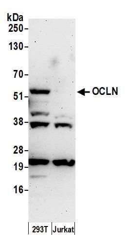 OCLN / Occludin Antibody (aa472-522)