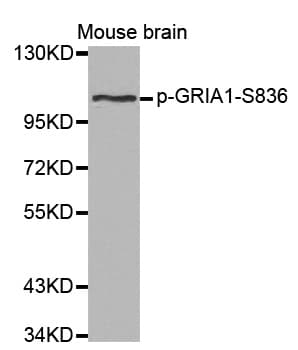 GRIA1 / GLUR1 Antibody (phospho-Ser836)