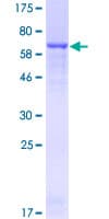 Human CPB / Carboxypeptidase B Protein (Recombinant GST)