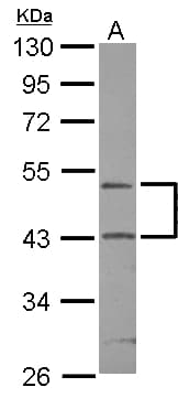 Polyclonal Rabbit anti-Human RUNDC3A Antibody (WB)