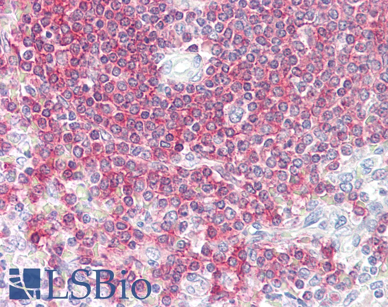 PathPlus™ Polyclonal Rabbit anti-Human BAD Antibody (aa119-168, IHC, WB)