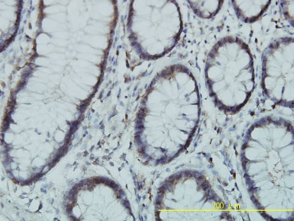 PGM3 Antibody (clone 1E2-1B12)