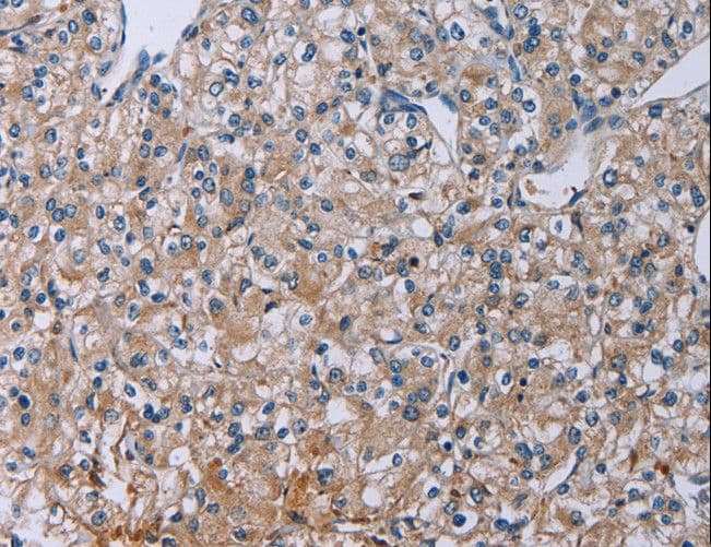 Polyclonal Rabbit anti-Human PLXND1 / Plexin D1 Antibody (IHC)