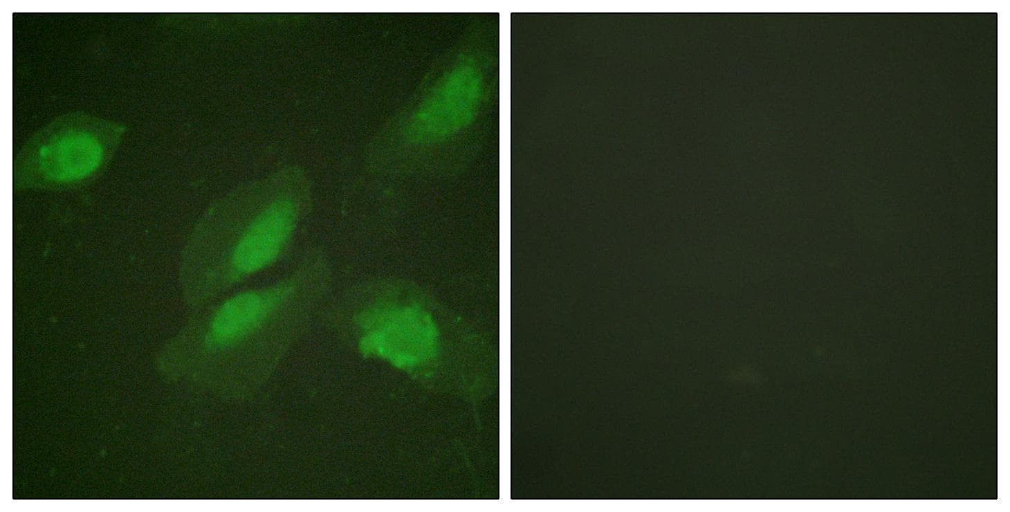 Polyclonal Rabbit anti-Human AKT1 Antibody (p326, IHC, IF, WB)