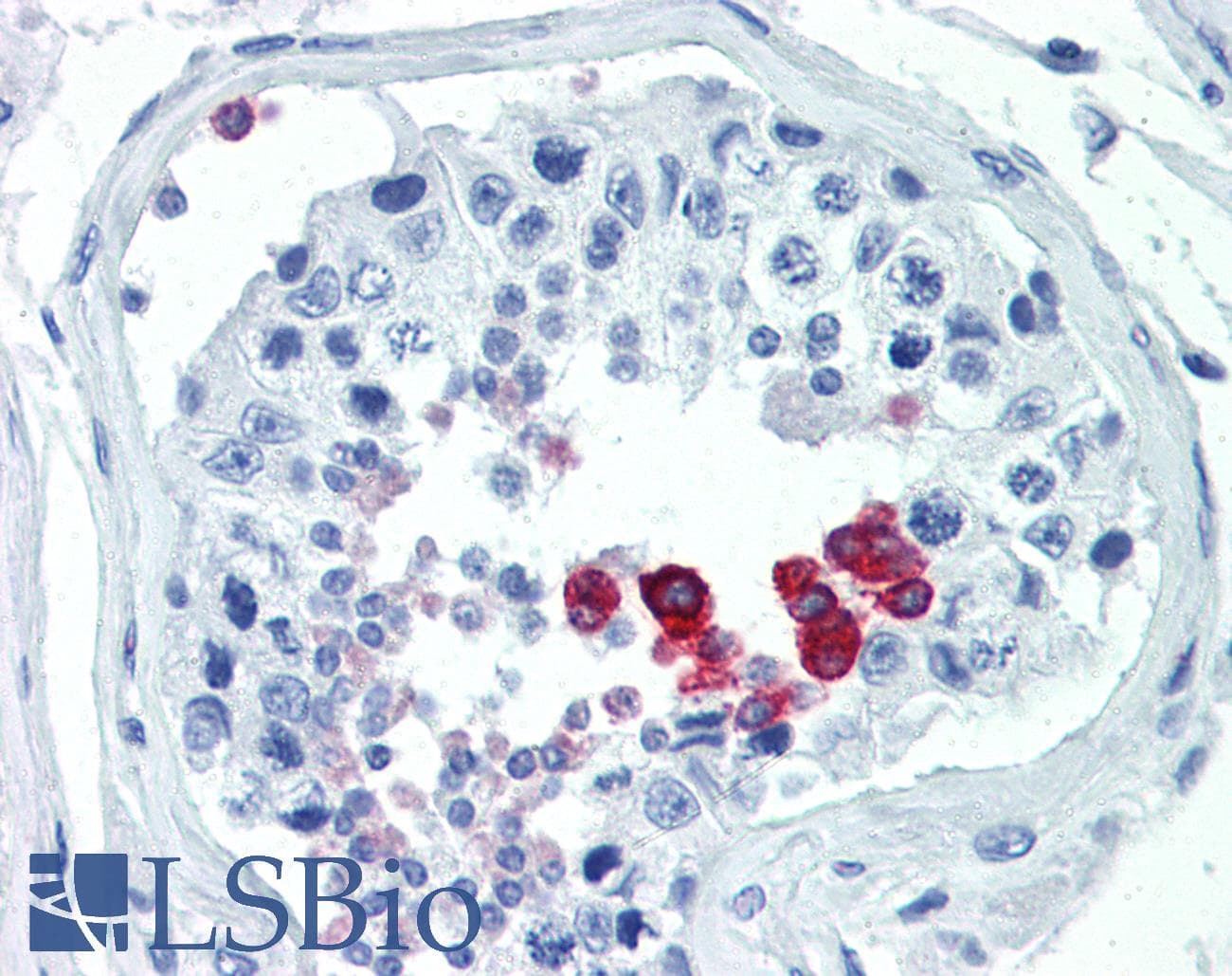 IHC-plus™ CCND1 / Cyclin D1 Antibody (aa68-97)