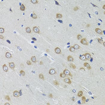 IKBKG / NEMO / IKK Gamma Antibody