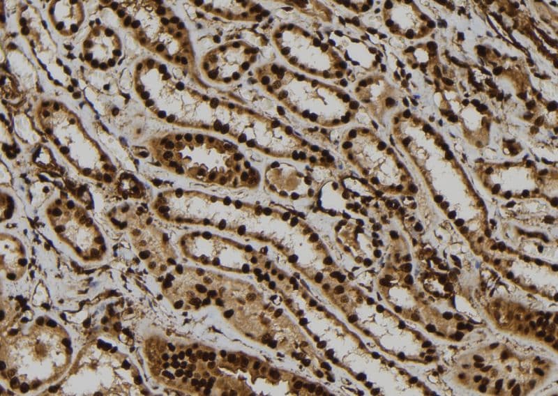 ATXN7L1 Antibody
