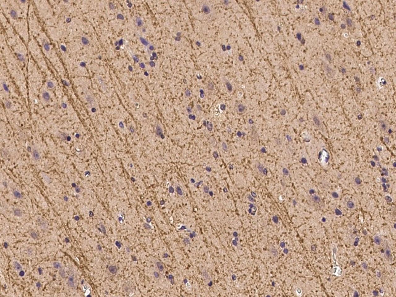 ZFHX2 / ZNF409 Antibody