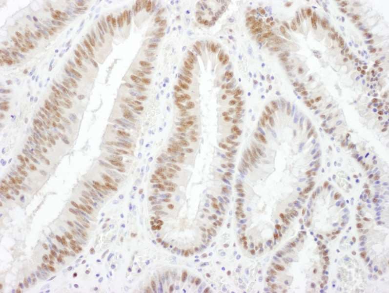 Polyclonal Goat anti-Human SMARCA4 / BRG1 Antibody (aa50-100, IHC, WB)