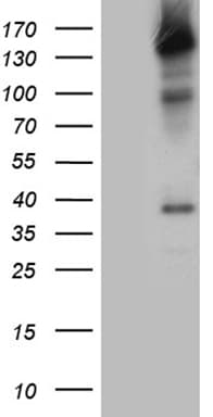 Monoclonal Mouse anti-Human SMC1A / SMC1 Antibody (clone OTI2D12, aa889-1016, IHC, WB)
