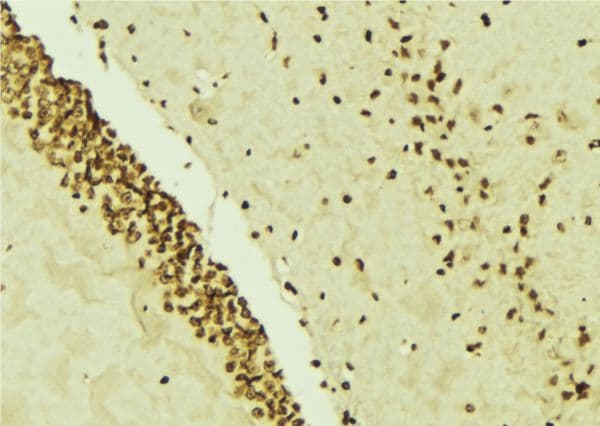 FBL / FIB / Fibrillarin Antibody