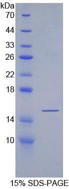 Rat SFRP5 Protein (Recombinant His)