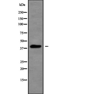 PRKACA Antibody