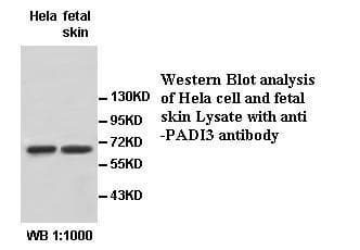 Polyclonal Rabbit anti-Human PADI3 Antibody (WB)