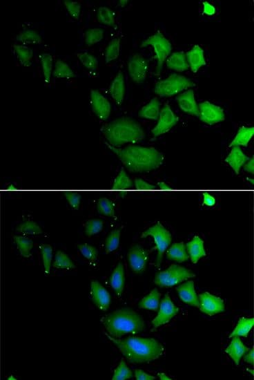 PSG1 / CD66f Antibody