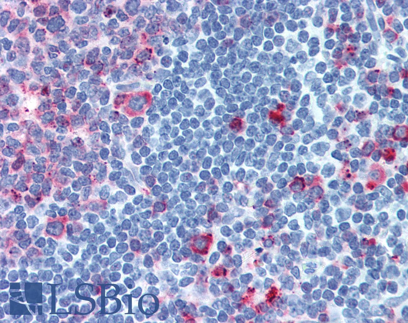 IHC-plus™ CELSR1 Antibody (C-Terminus)