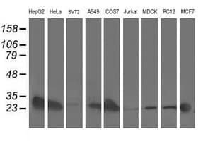 AK4 / Adenylate Kinase 4 Antibody (clone OTI3B1, Carrier-free)