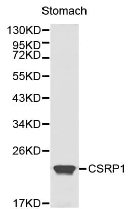 Polyclonal Rabbit anti-Human CSRP1 Antibody (IHC, WB)