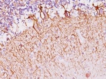 Neurofilament Antibody (clone SPM145)