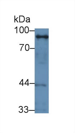 GOK / STIM1 Antibody (aa1-211)
